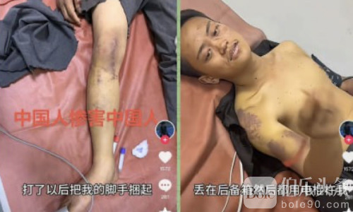 拒做诈骗被打断手脚！中国博主非洲跳车逃生惊魂72秒