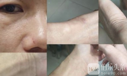 中国男子被熟人卖进园区，9天电击吊打，亲友筹钱赎回！