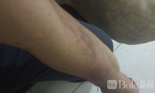 小菲最近都穷疯了？开始组团持枪抢劫中国人！