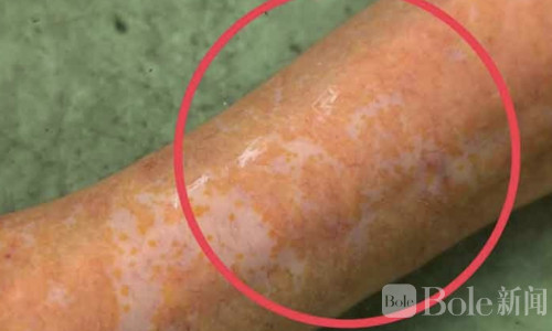 泰北农田惊现金色大鳗鱼，中段数字引彩民关注