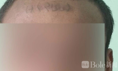 缅军内部纪律曝光：逃兵被抓回后遭脸部刺字标记