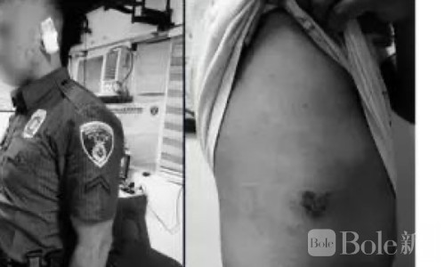 屋顶挥刀狂叫还咬警察！马尼拉男子失控连伤两警