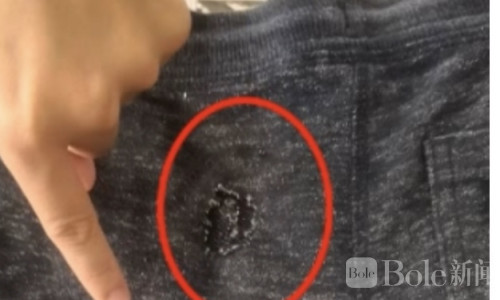 血腥一幕！9岁男童遭狗撕咬睾丸受伤，主人竟拒认