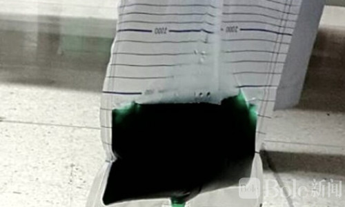 差点丧命还尿出绿色液体！专家终于说出真相
