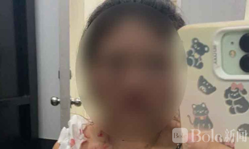 泰国女子遭闺蜜男友殴打重伤，坚持报案拒绝和解